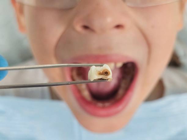 Best Emergency Cosmetic Dentistry in Kansas City, MO